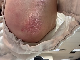 Elbow