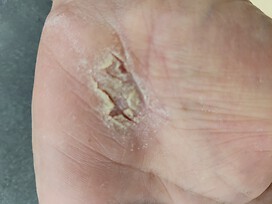 my left palm