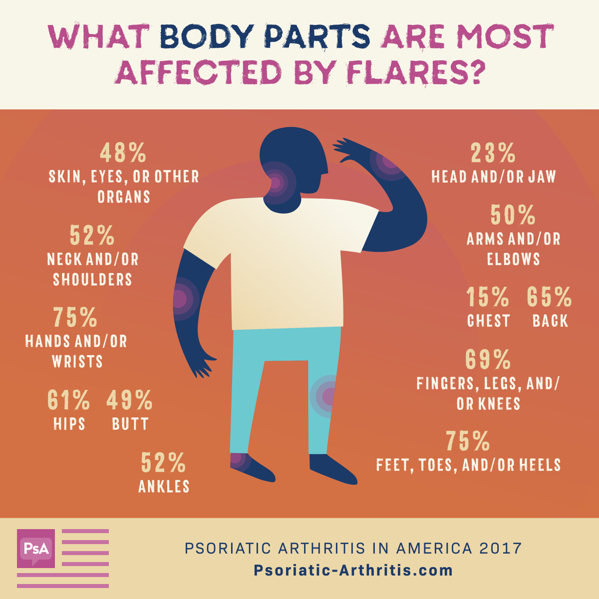 Body Parts Affected by Flares