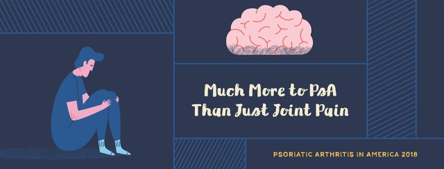 Psoriatic Arthritis: More Than Just Joint Pain image