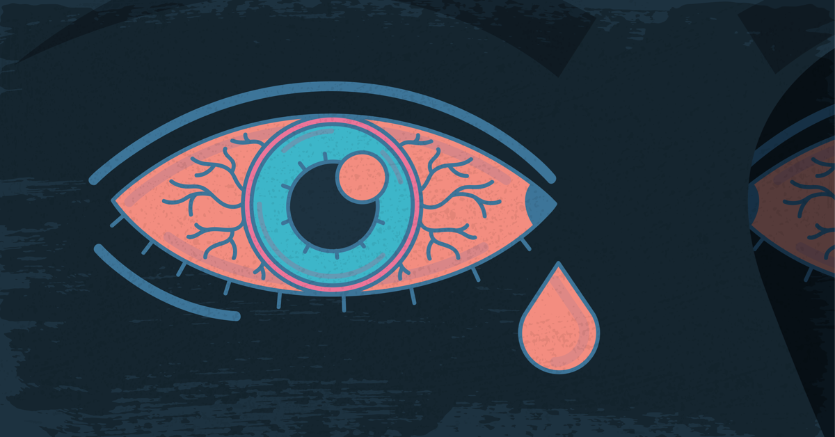 How Does Psoriatic Arthritis Affect the Eyes?