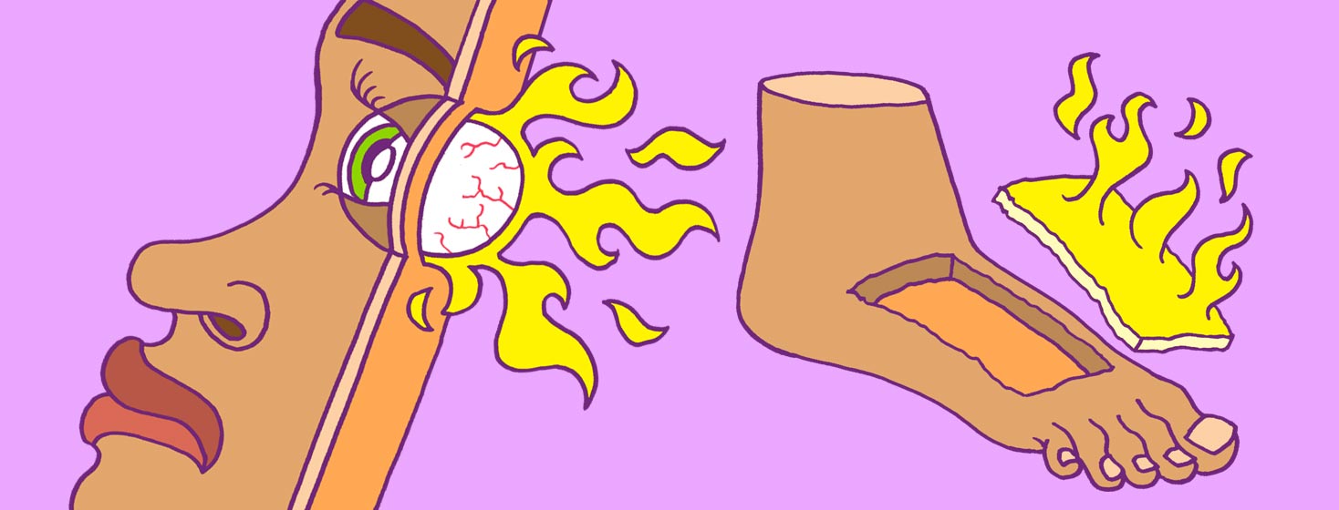 Strange symptoms of psoriatic arthritis including an inflamed eye and foot with inflamed skin