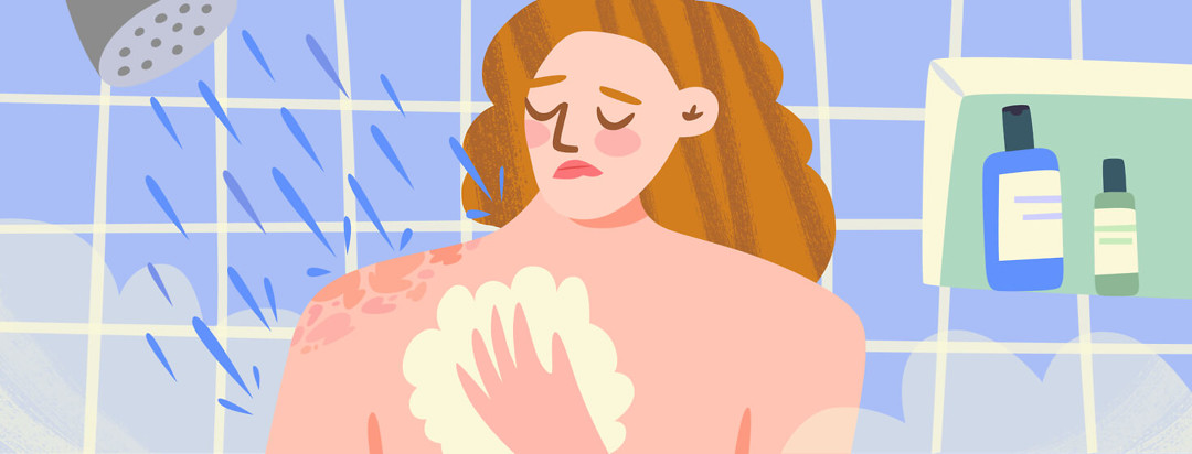 Woman with psoriasis in the shower looking uncomfortable