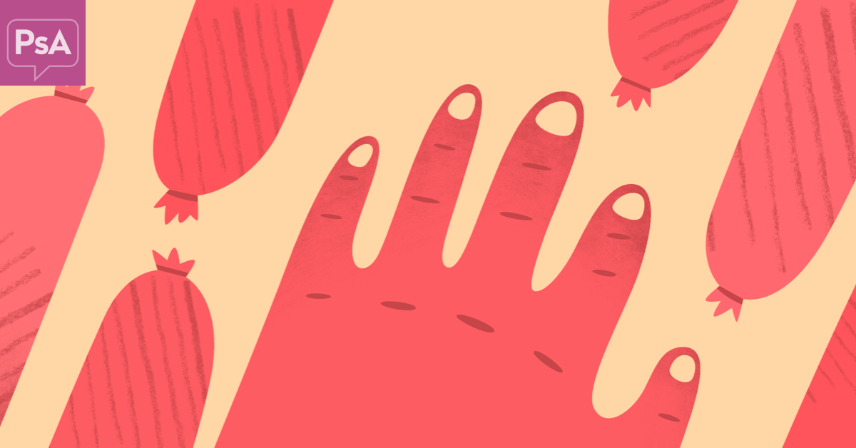 Psoriasis, Sausage Fingers and Psoriatic Arthritis