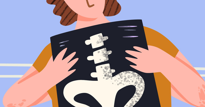 Going For An X-Ray? Here’s What To Expect image