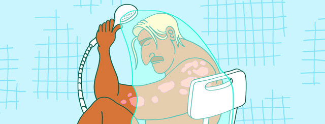 Community Views: The Pains of Showering with Psoriatic Arthritis image