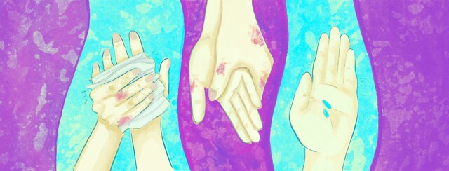 Psoriatic Arthritis in the Hands image
