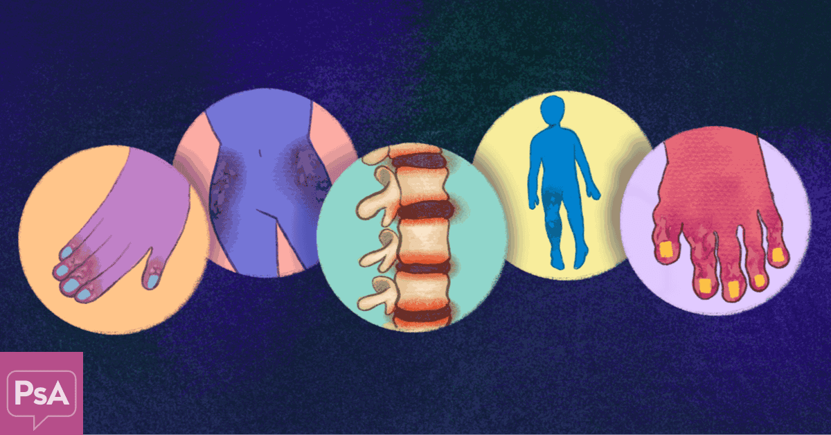 What Are The Five Different Types of Psoriatic Arthritis?