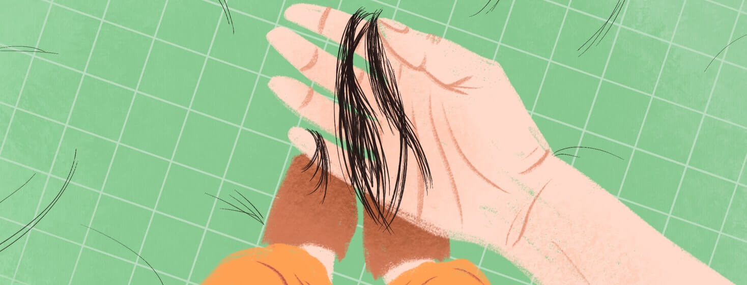 A person with hair loss holds strands of hair that have fallen out