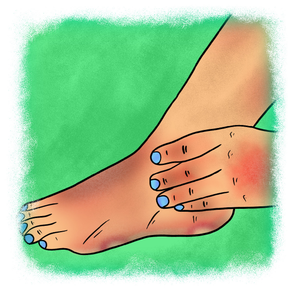”Blisters on hands and feet