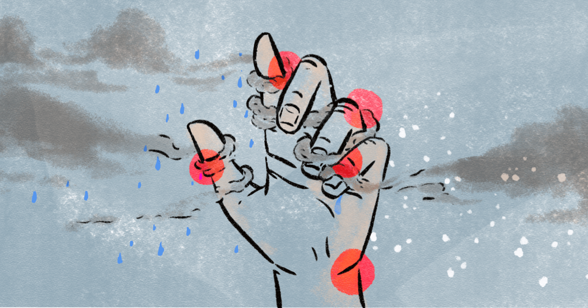 Dreary Days and Joint Pains