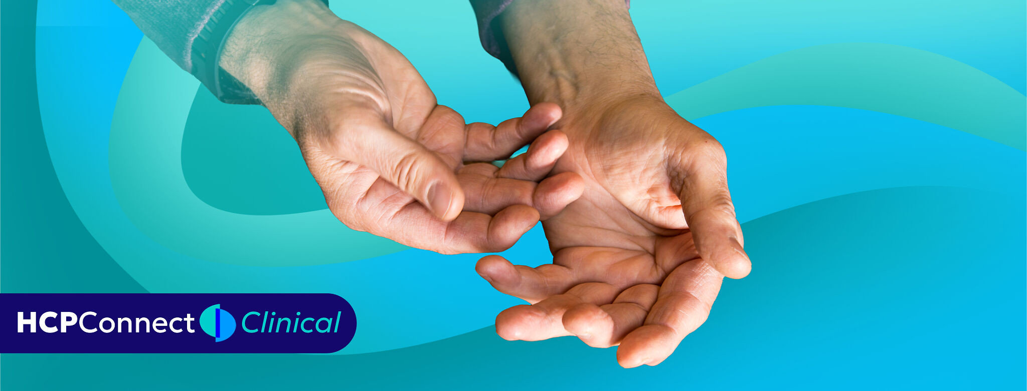 The hands of a person with arthritis